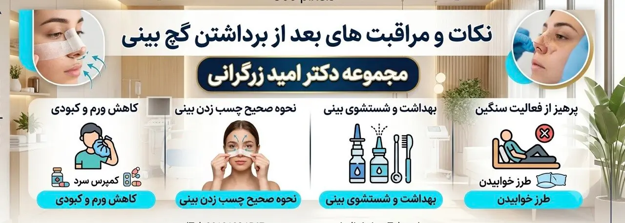 نکات بعد از برداشتن گچ بینی