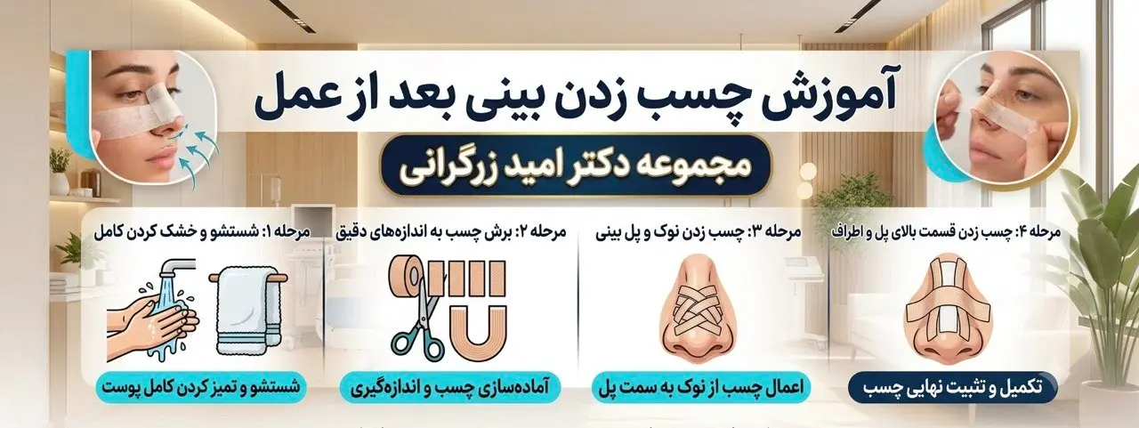 آموزش چسب زدن بینی بعد از عمل